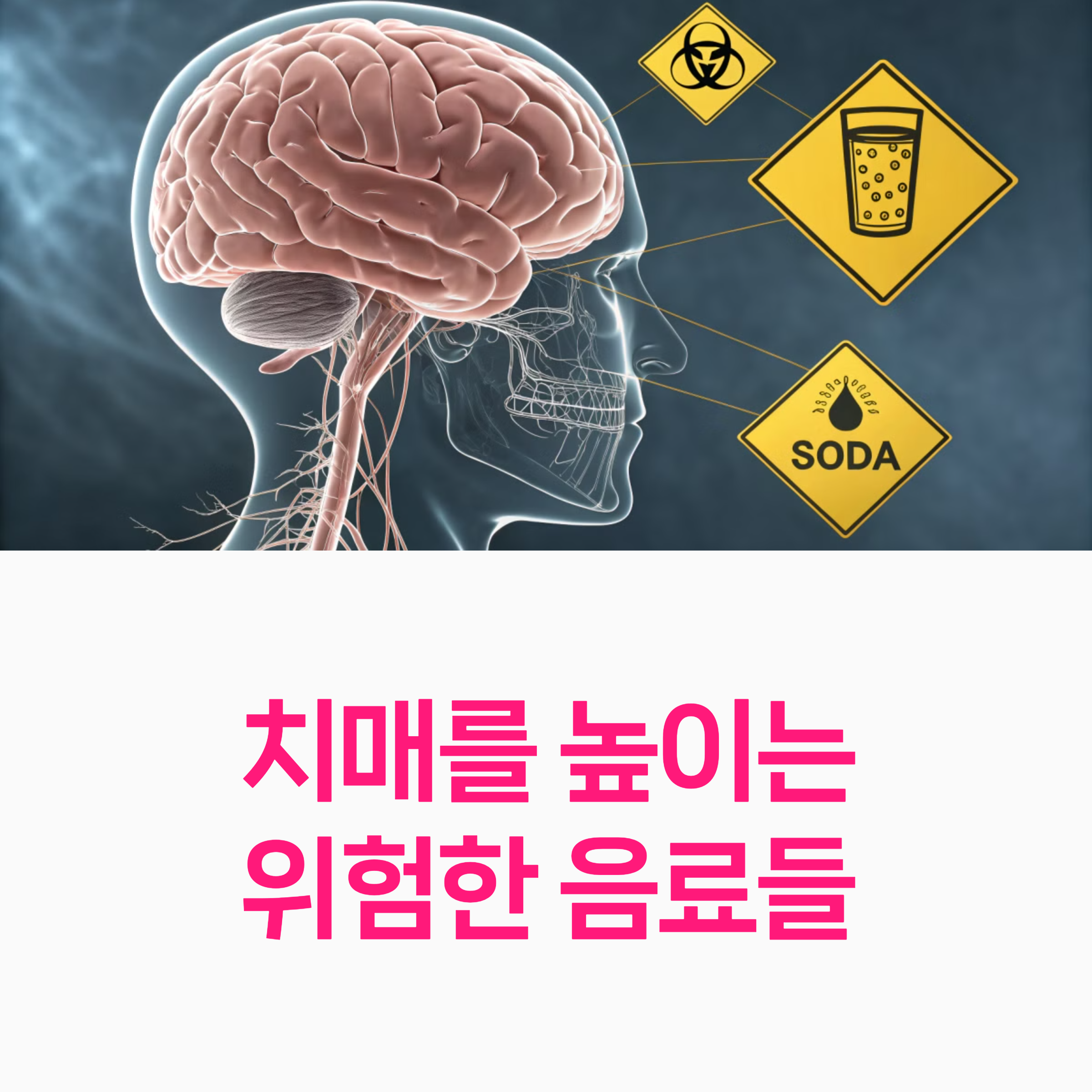 치매예방