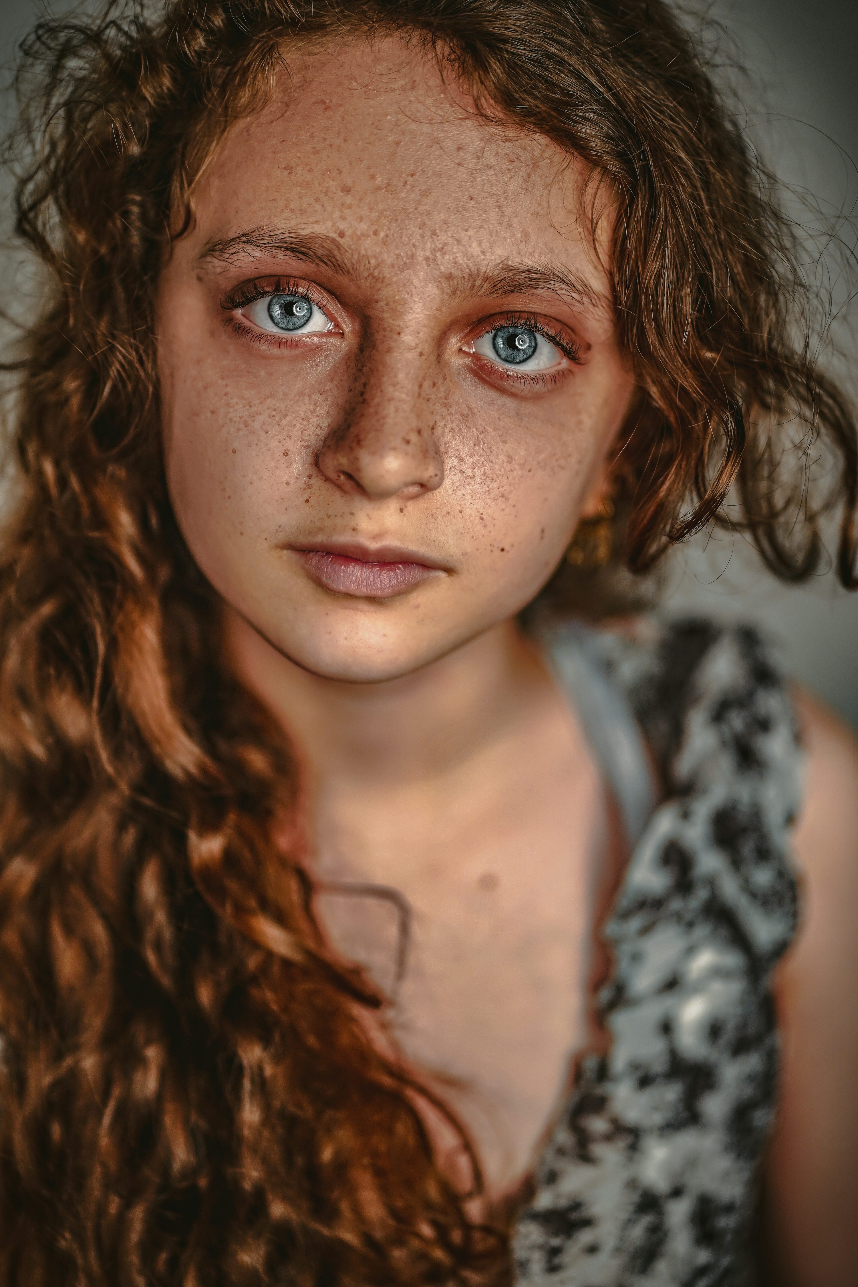 여드름 흉터 없애는법