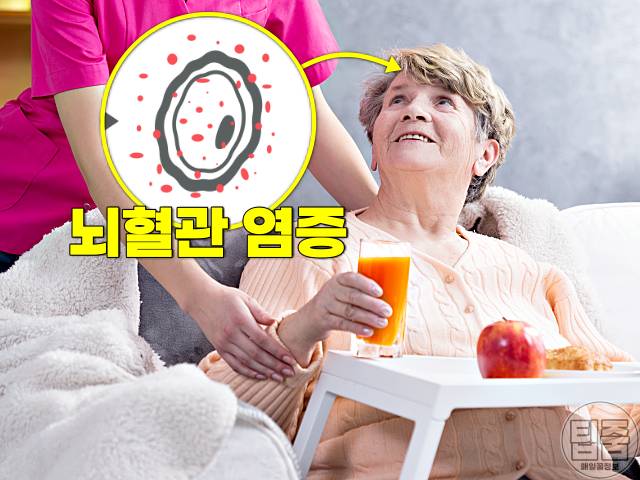 당근주스 효능 뇌혈관 염증 치매