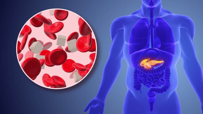이 이미지는 공복혈당 높은 이유에 관한 포스팅을 설명하기 위한 참고 사진입니다.