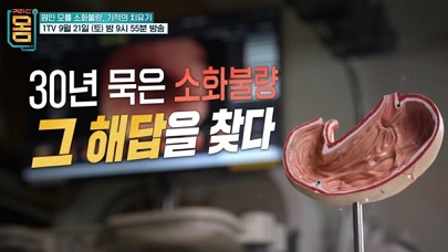 30년소화불량