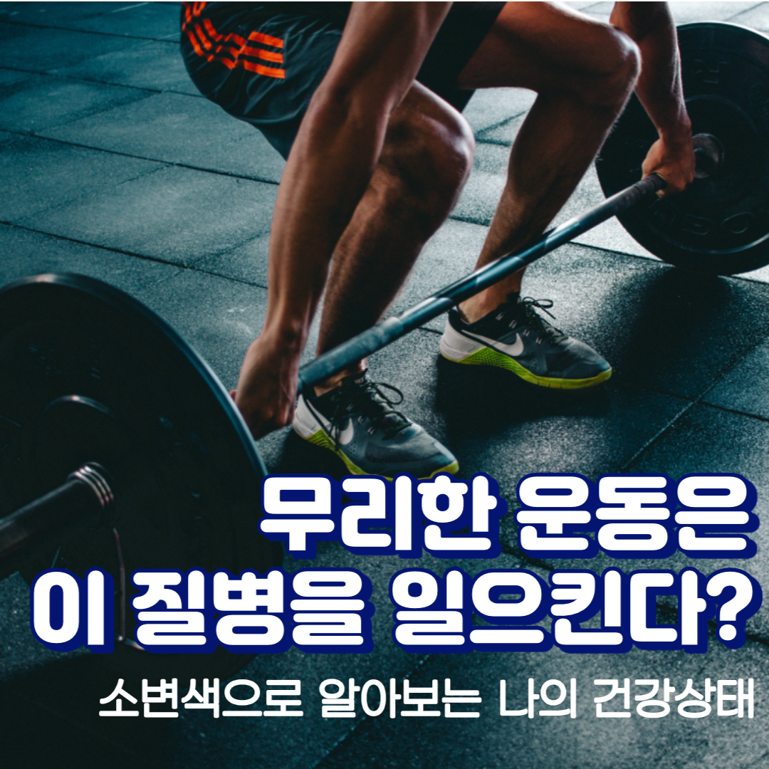 소변색이 갈색