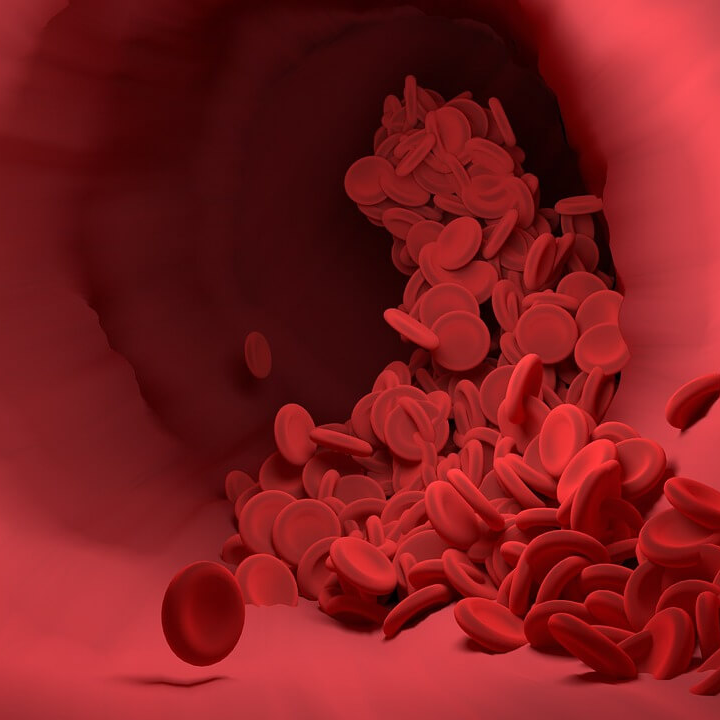 좋은 콜레스테롤 혈관청소