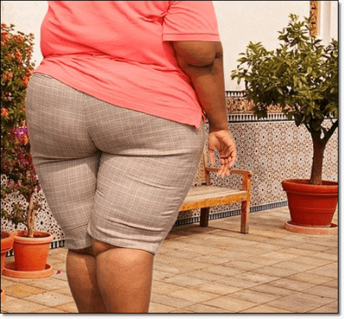 미골통 요인 과체중