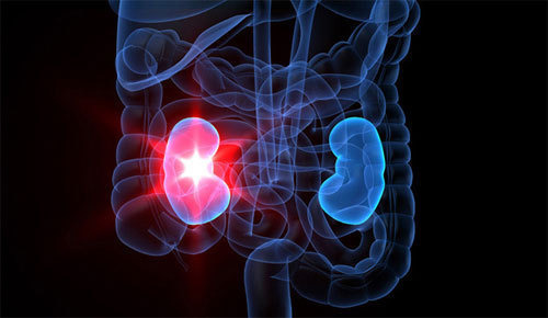 신장에 안좋은 채소, 야채