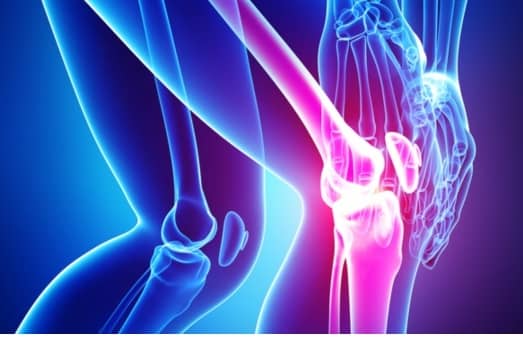 무릎 통증 사진