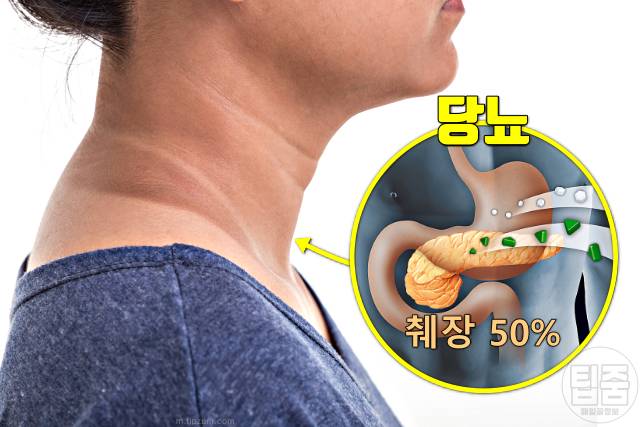 당뇨에 좋은 음식 과일 고기 생선 반찬