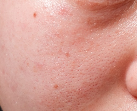 사용후기-사진3