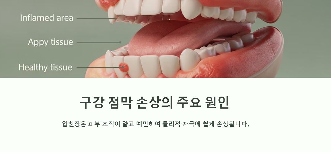 입천장이 헐었을때