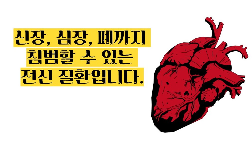 루푸스병 이란