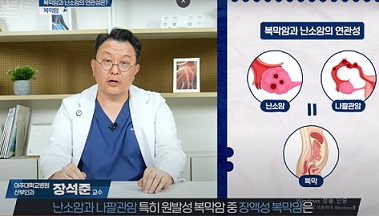 복막암과난소암연관성