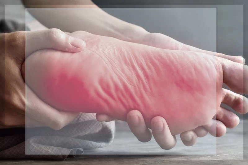 근저족막염 발바닥 통증