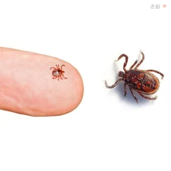 진드기 물린자국 대처법 참진드기 빨간 진드기 증상 확인_8