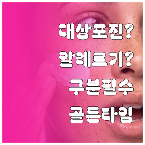 대상포진과 알레르기 차이점과 치료 골..