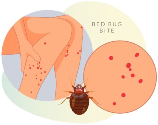 물린자국 일러스트 이미지