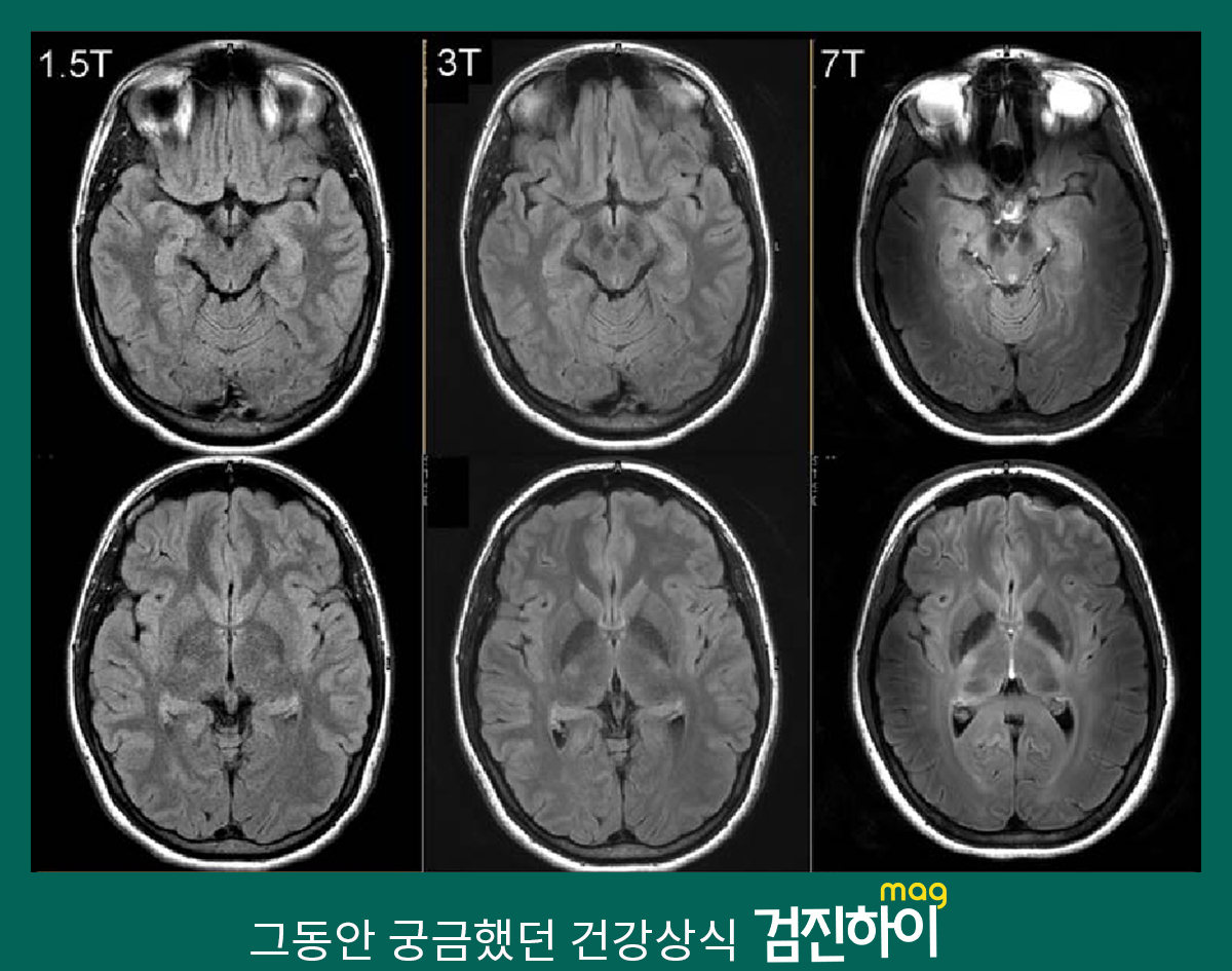 MRI 비용 비교 실비보험 적용
