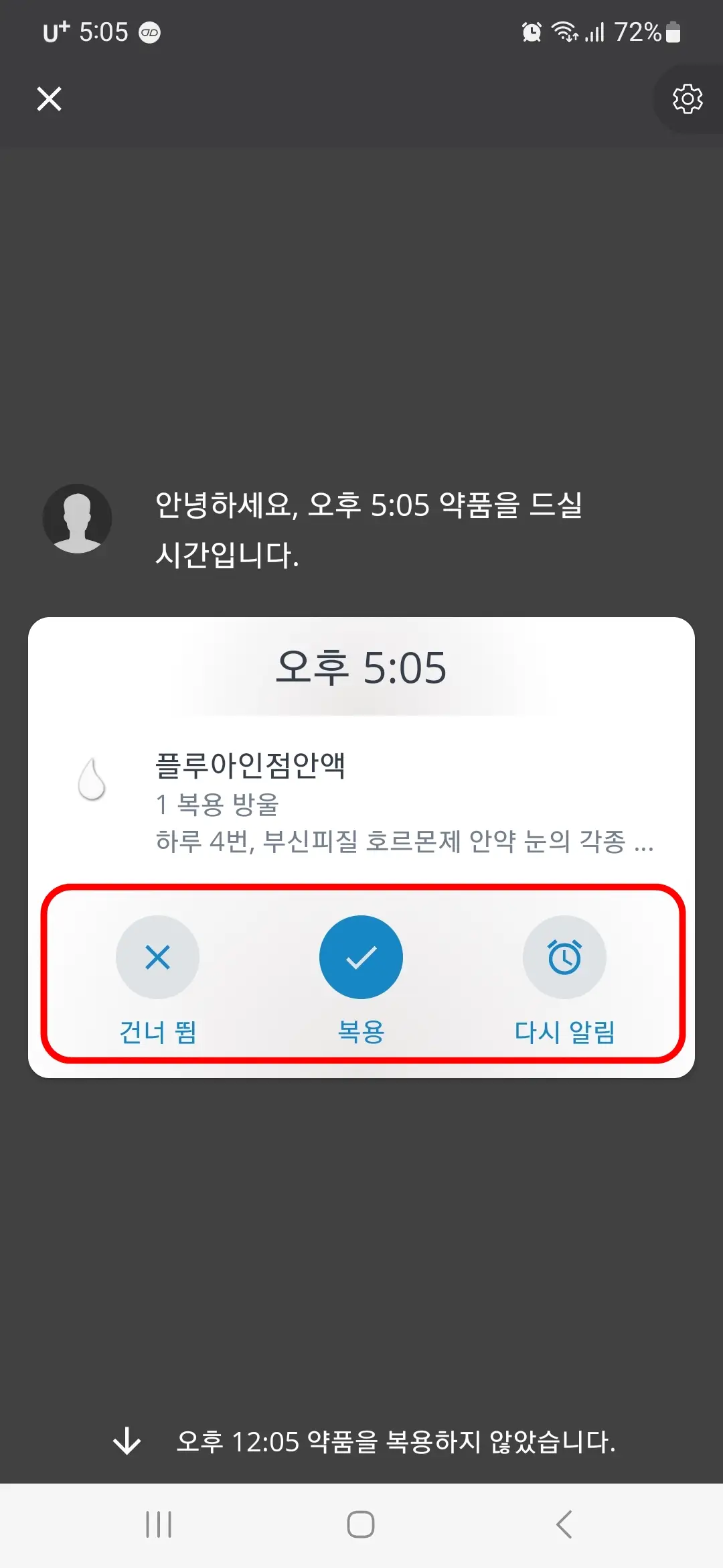 건너 뜀 복용 다시 아림