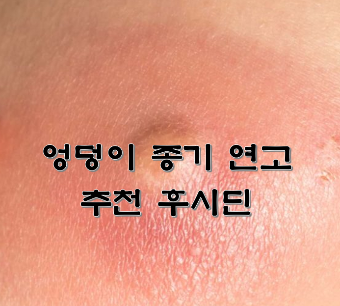 엉덩이 종기