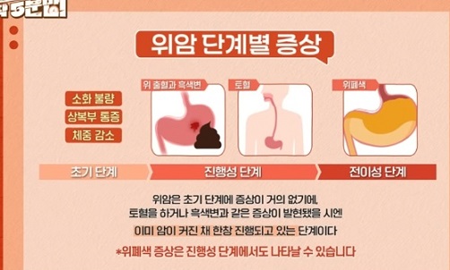 위암증상