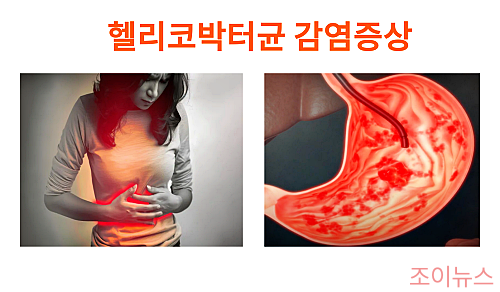 헬리코박터균의 감염 증상