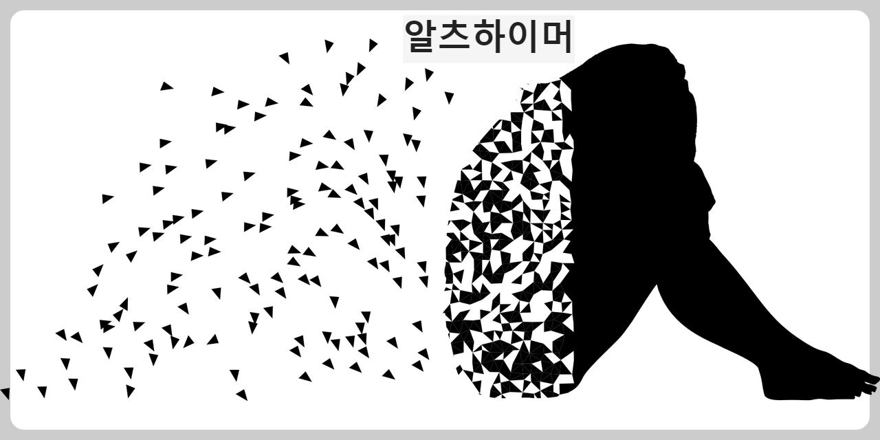 알츠하이머