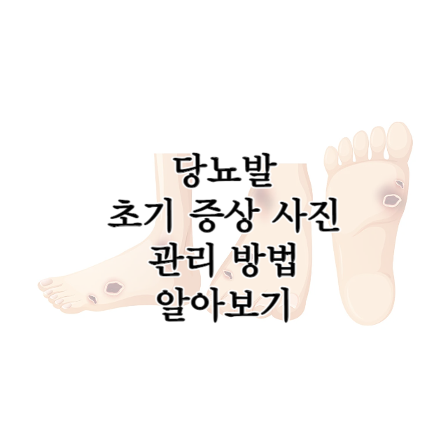 당뇨발-초기-증상-사진