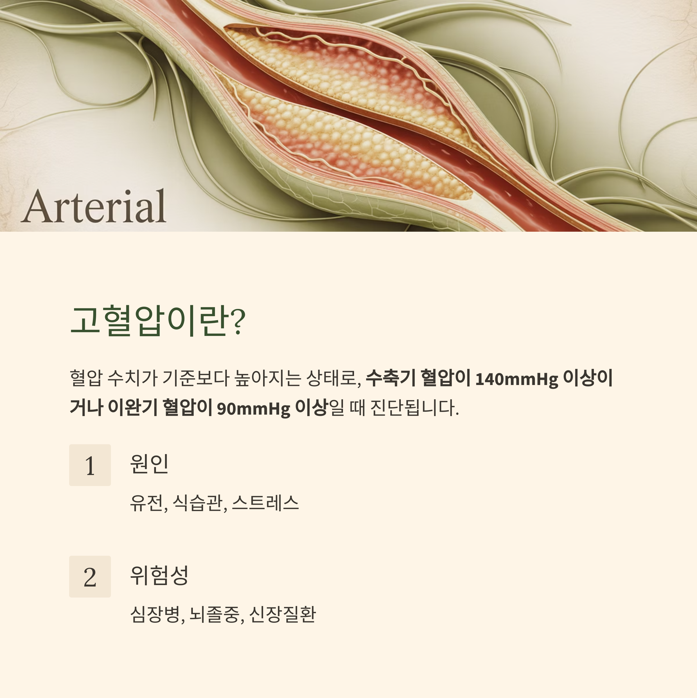 동맥 내부를 해부한 일러스트와 함께 고혈압의 정의, 원인, 위험성을 설명하는 건강 정보 안내 이미지