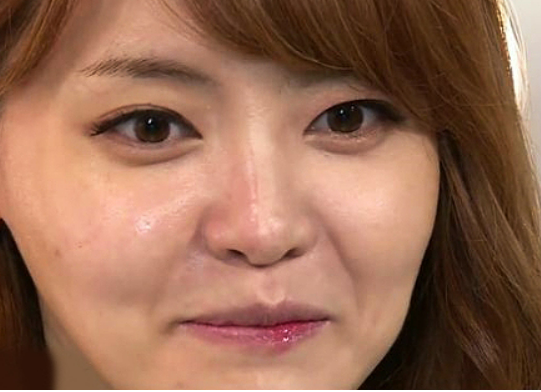 갑상선 기능 항진증 증상, 원인, 검사, 좋은 음식