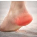 발바닥통증의 원인
