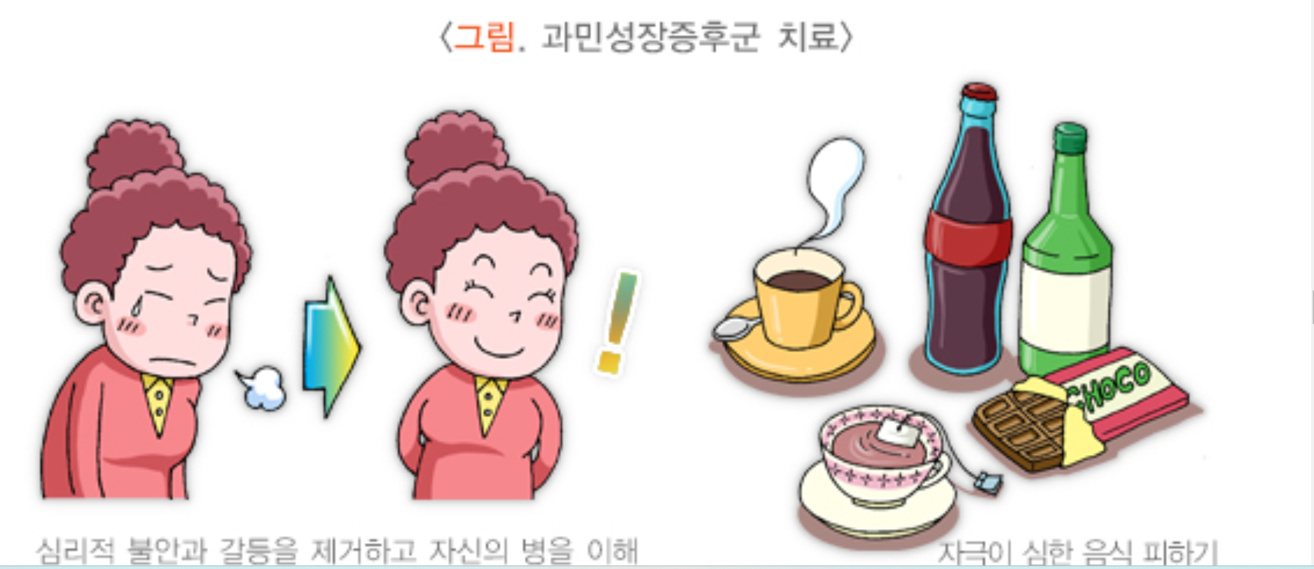 과민성 대장증후군에 나쁜 음식 피하기