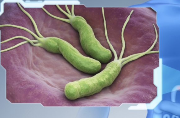 헬리코박터균 7