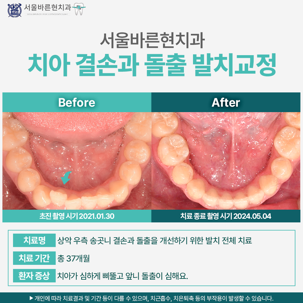 해운대 교정치과