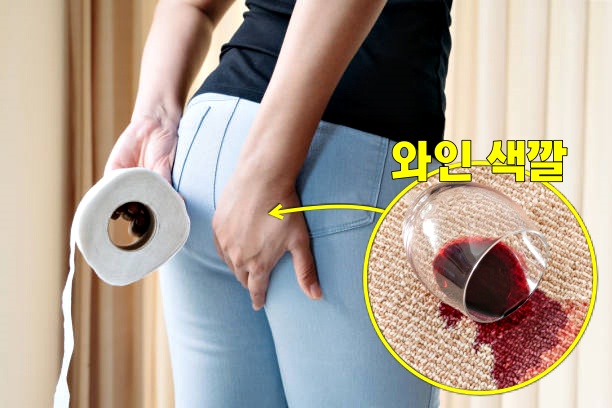 대장암 초기증상, 혈변 붉은색변, 대장암 증상, 건강 팁줌 매일꿀정보