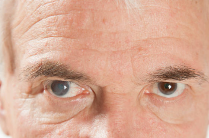 백내장 증상, 수술비용, 수술후 시력회복 기간 총정리 (2024ver)