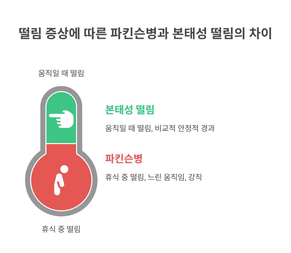 파킨슨병과 본태성 떨림의 차이