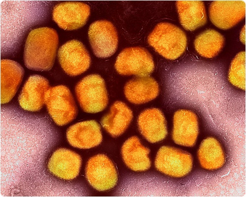 엠폭스 증상 및 원인