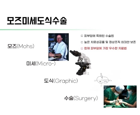 모즈미세도식수술-김훈수교수