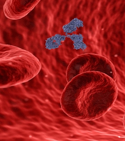 양파 효능 사진22
