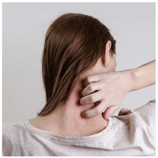 건선, 평생을 함께하는 만성 염증 질환