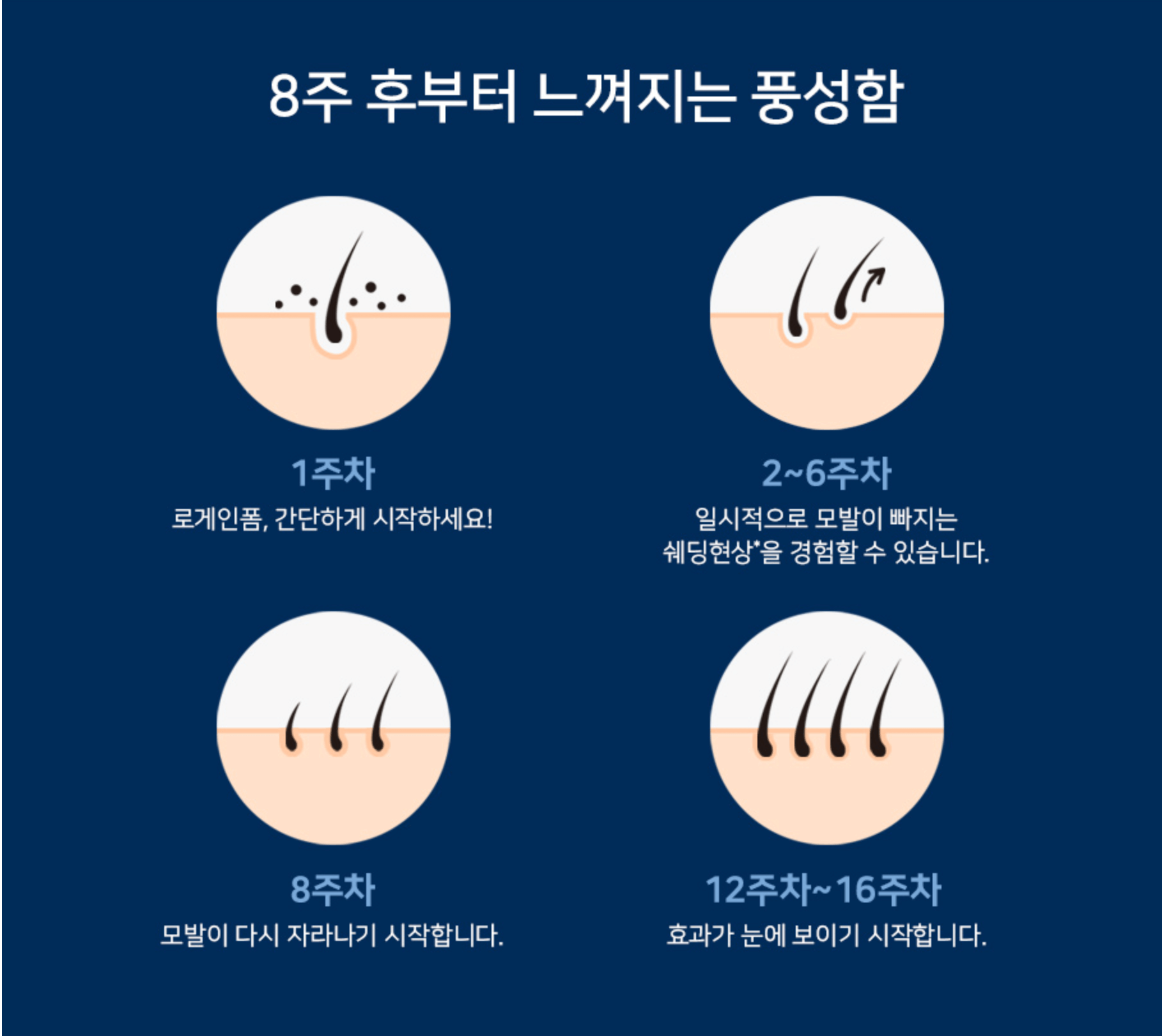 로게인폼 후기1