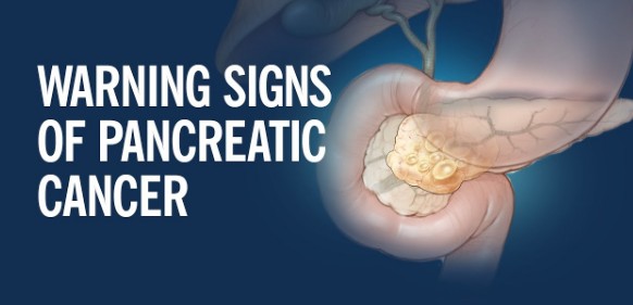 췌장암의 정의, 원인, 초기증상, 완치율, 좋은 음식 나쁜음식