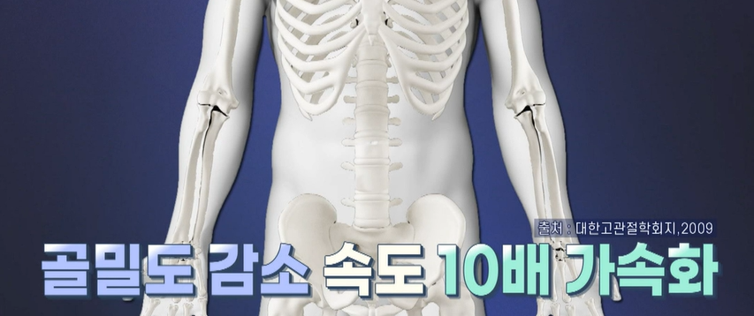 골다공증