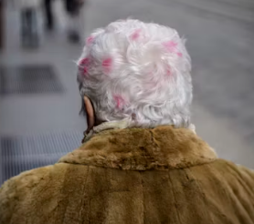 간경변증 치료방법 진단기준 합병증