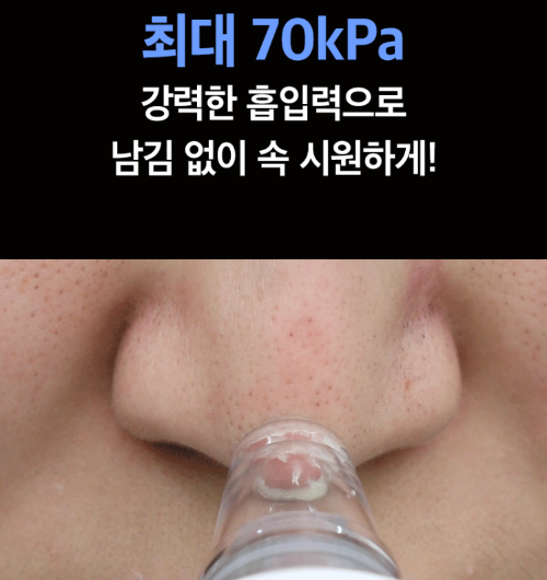 진공피지제거기