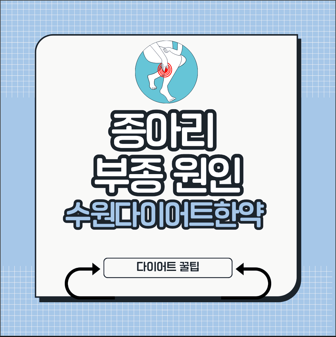 수원다이어트한약 종아리 부종 원인 확인해보세요!