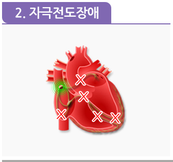 부정맥 증상