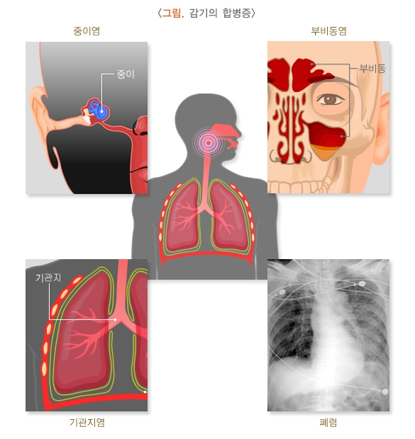 환절기 감기 예방법