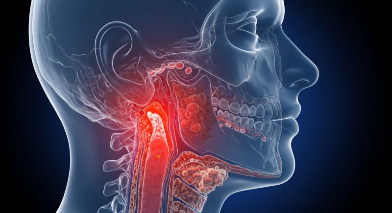 비인두염 증상 원인부터 치료까지 총정리
