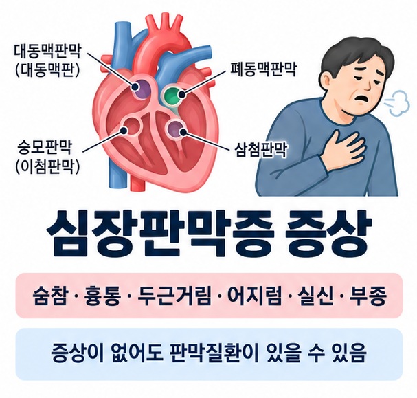 심장판막증 증상과 숨참 흉통 두근거림 어지럼 실신 부종을 보여주는 의료 교육용 이미지