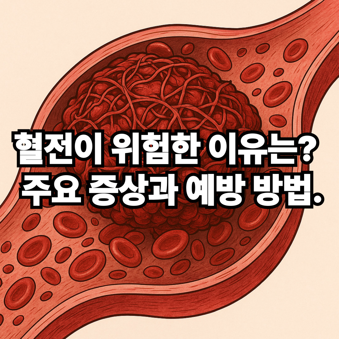 혈전이 위험한 이유는? 주요 증상과 예방 방법